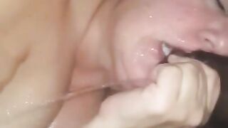 Papules being sucked by her