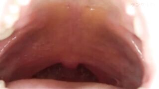 Mouth Uvula 13