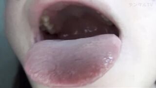 Mouth Uvula 13