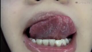 Mouth Uvula 10