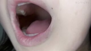 Mouth Uvula 10