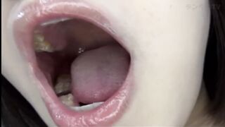 Mouth Uvula 10