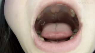 Mouth Uvula 6