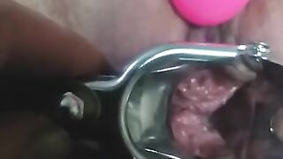 close up speculum and internal veiw of squirting